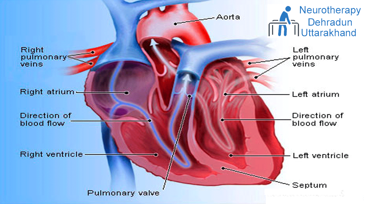 Heart Disorders