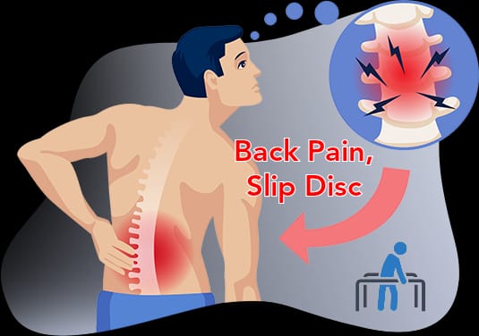 Back Pain, Slip Disc