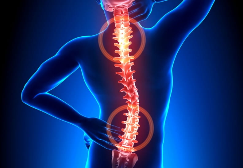 Cervical Spondylitis