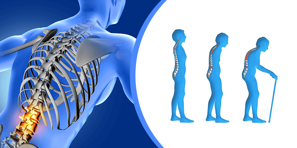 Orthopaedics Knee Osteoarthritis