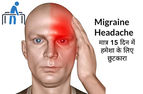 Migraine Headache